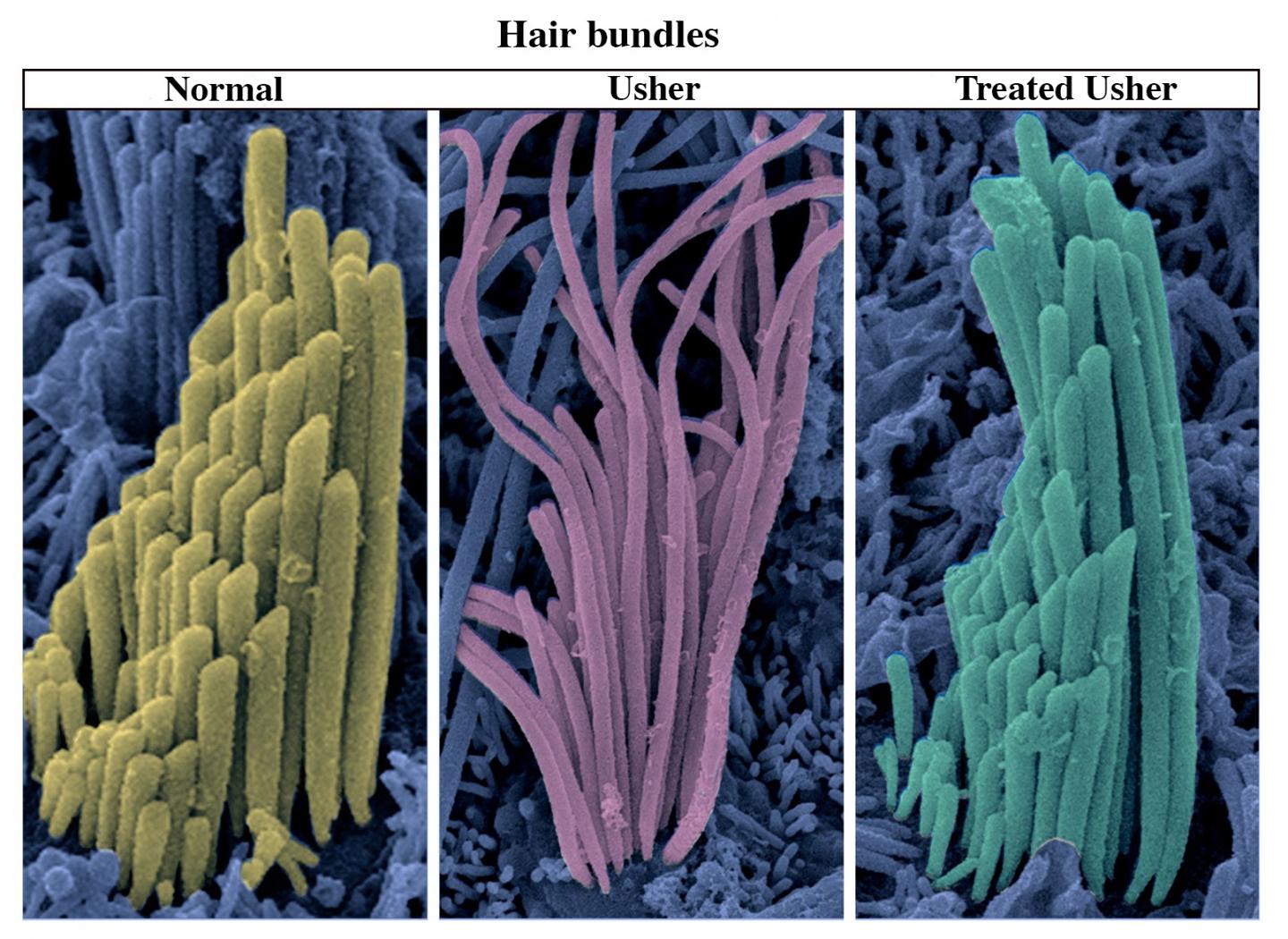 hair cells inner ear